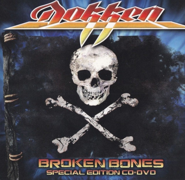 Broken Bones