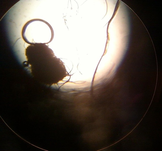 Vein