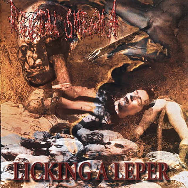 Licking a Leper
