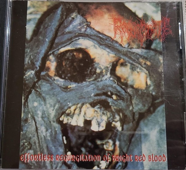 Effortless Regurgitation of Bright Red Blood