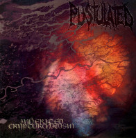 Album cover for Inherited Cryptorchidism