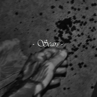 Scars