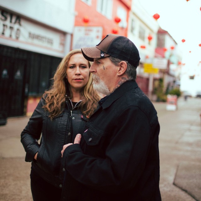 Extra‐Capsular Extraction